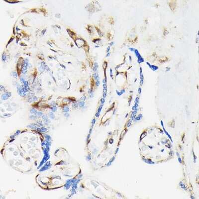 Immunohistochemistry-Paraffin: VASP [p Ser239] Antibody [NBP3-16890] - Immunohistochemistry of paraffin-embedded human placenta using VASP Rabbit pAb (NBP3-16890) at dilution of 1:50 (40x lens).Perform high pressure antigen retrieval with 10 mM citrate buffer pH 6.0 before commencing with IHC staining protocol.